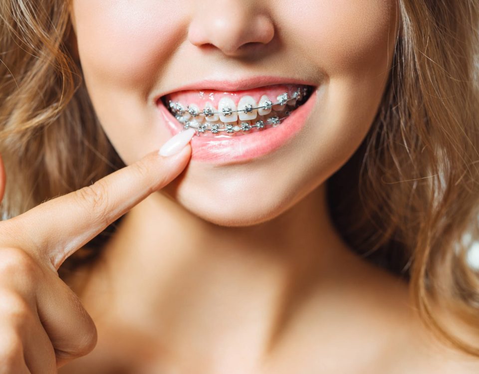 aparat ortodontyczny a leczenie zębów u dentysty
